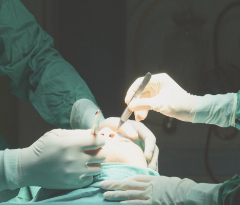 glaucoma